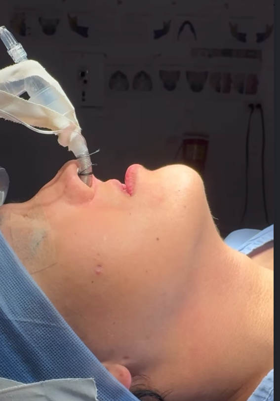 Cirugía ortognática